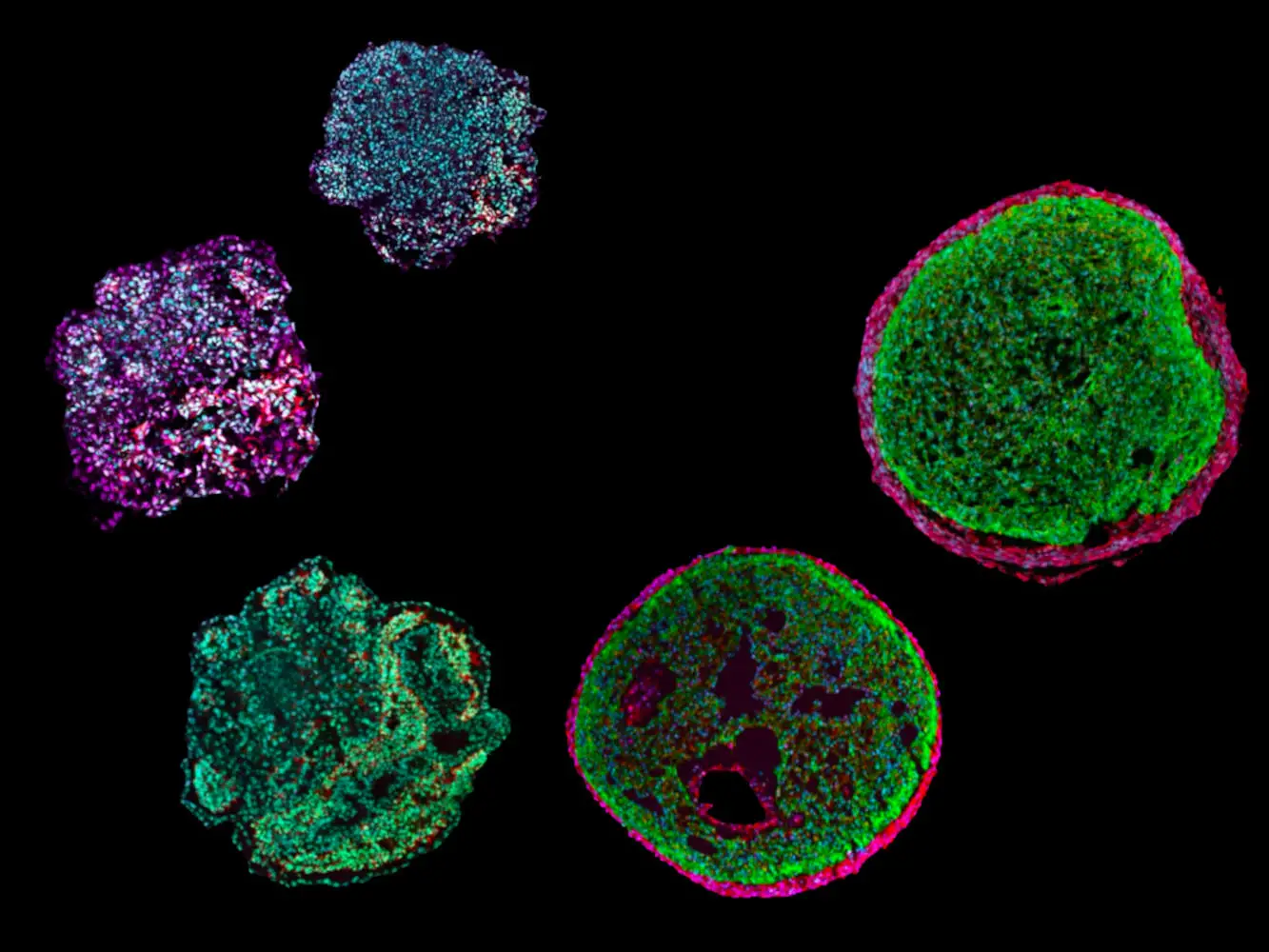 Various-Stages-in-the-Development-of-Heart-Organoids.webp