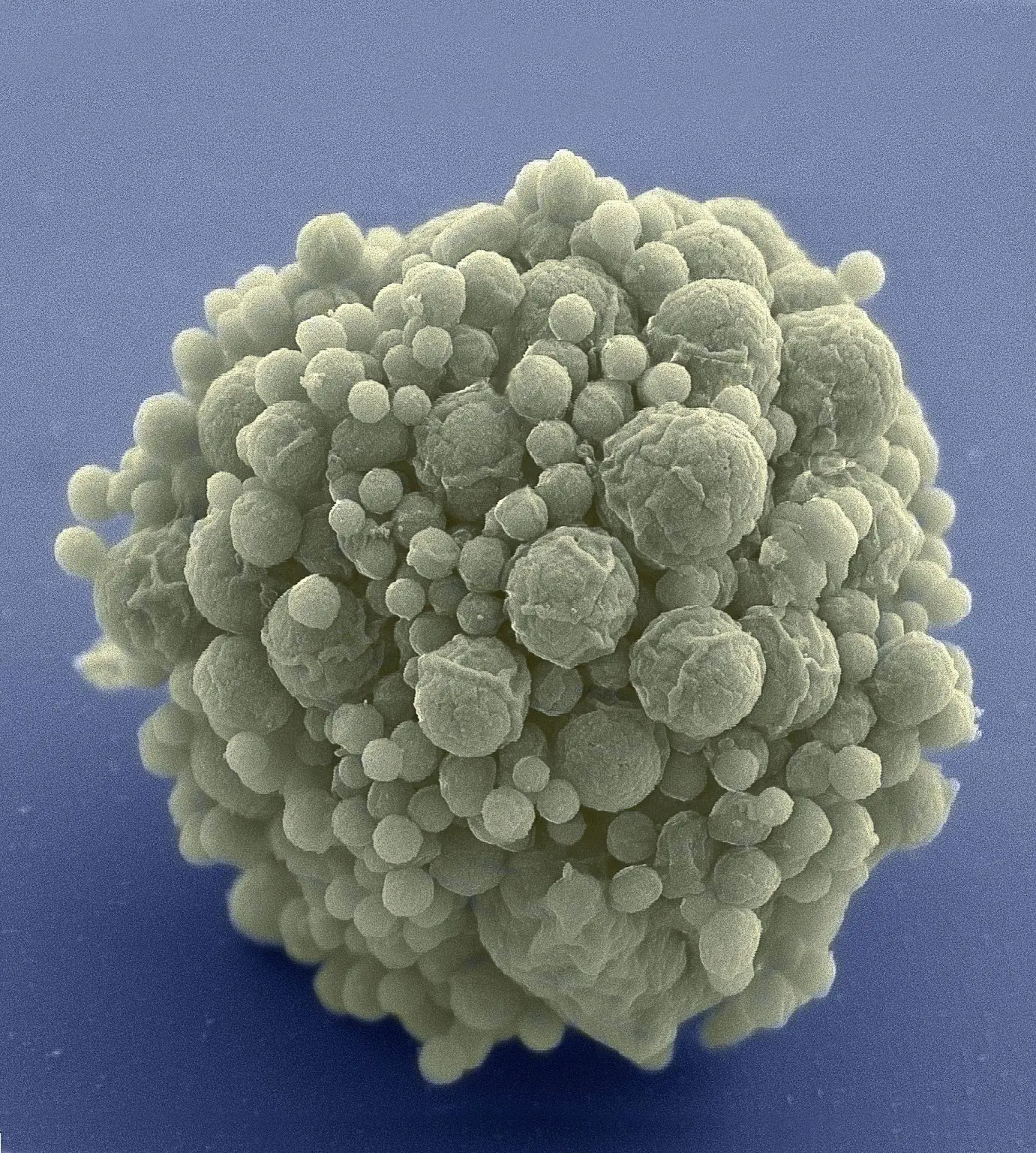 Cluster-of-Minimal-Cells-Electron-Micrograph-1381x1536.webp