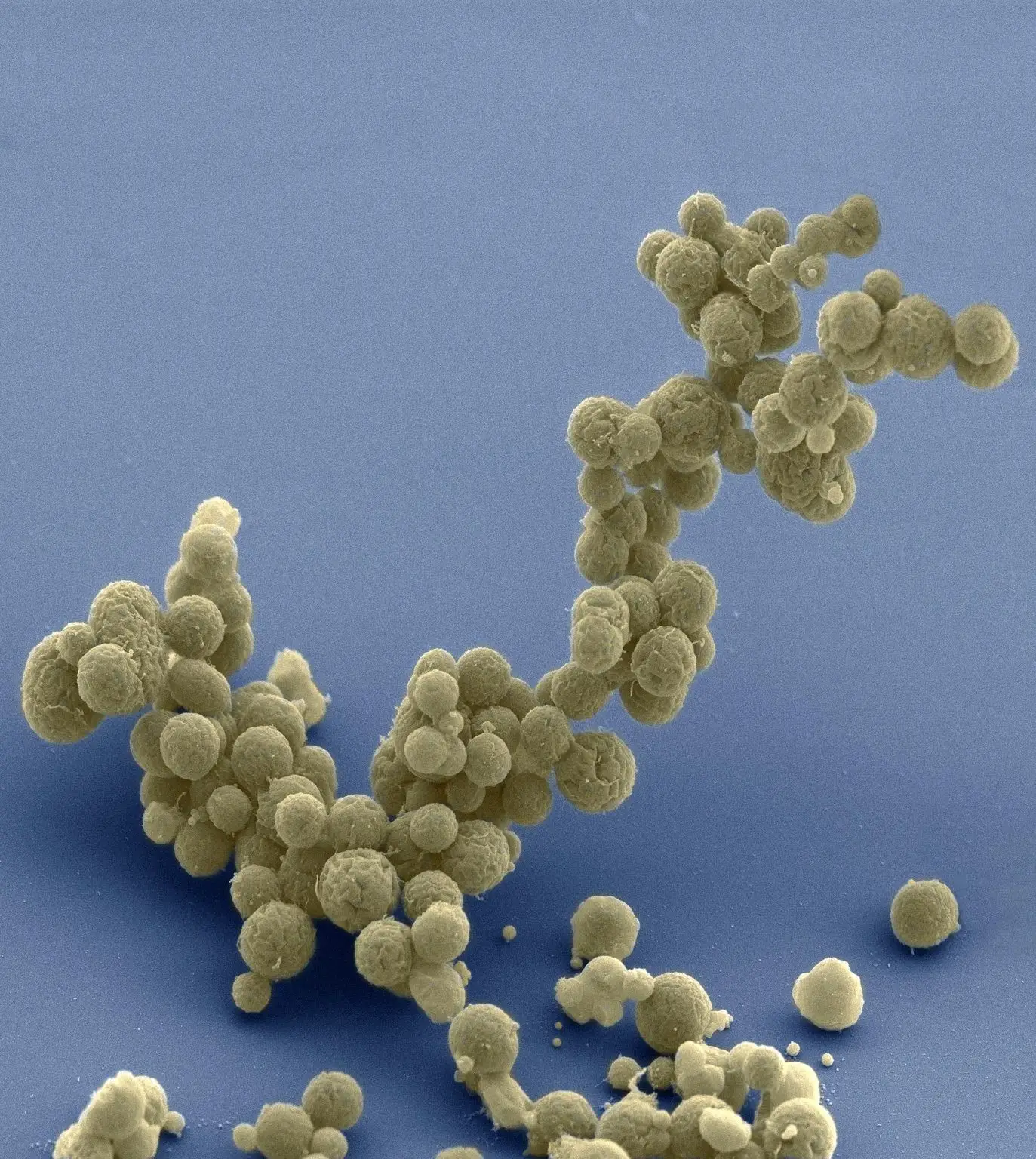Minimal-Cells-Electron-Micrograph-1373x1536.webp