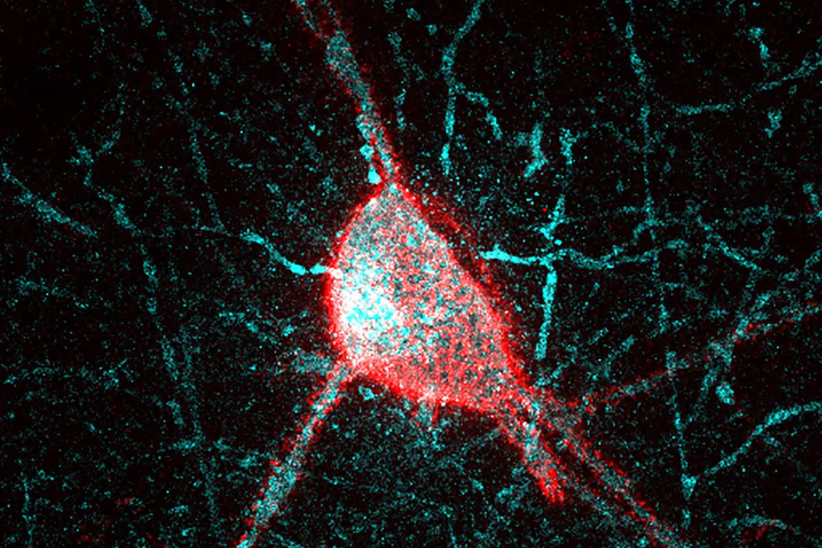Parvalbumin-Interneuron-Surrounded-by-the-Perineuronal-Net.webp