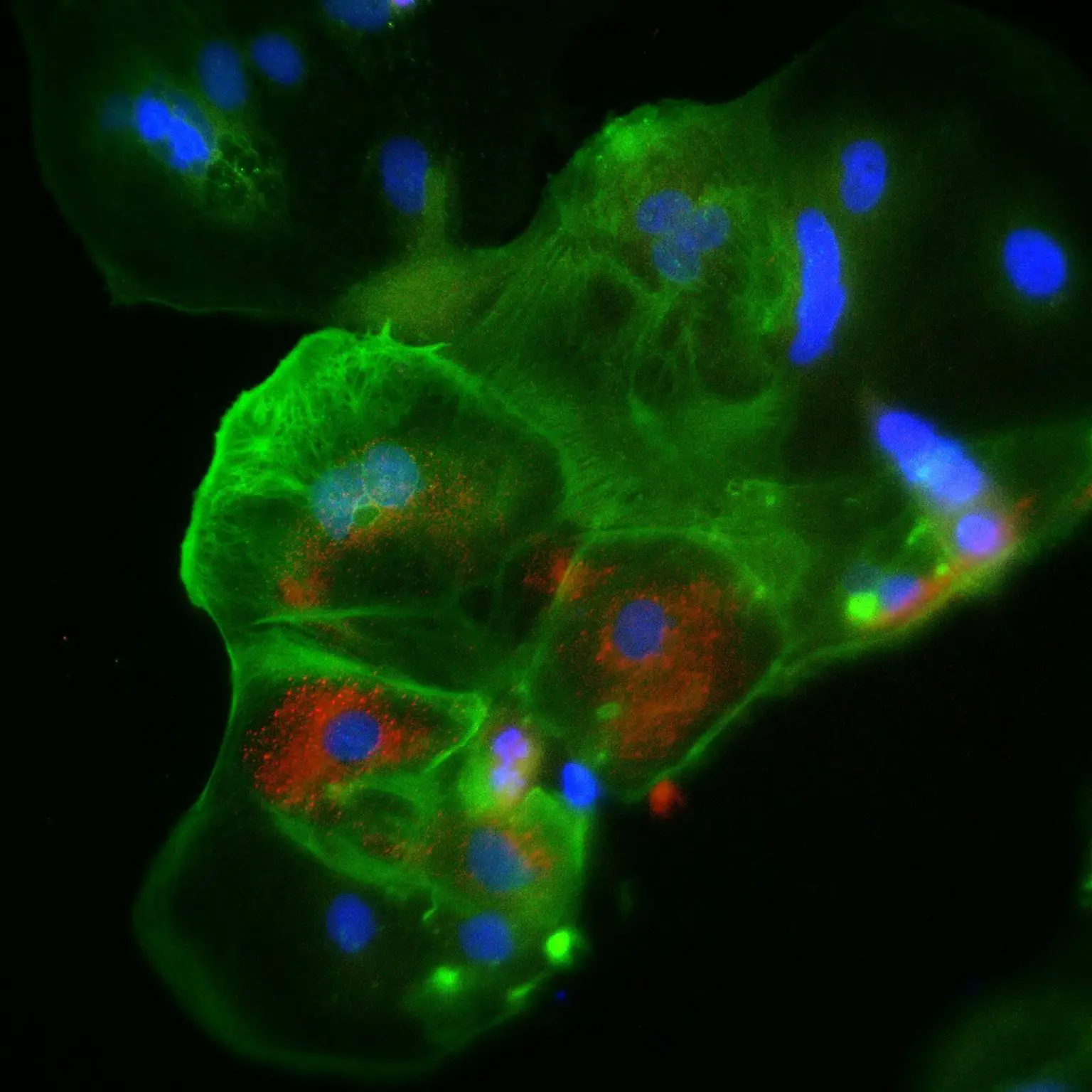 Placenta-Cells-Infected-SARS-CoV-2-Virus-1536x1536.webp