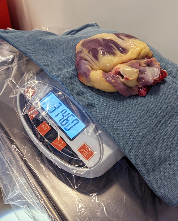 haltd-donor-heart.jpg