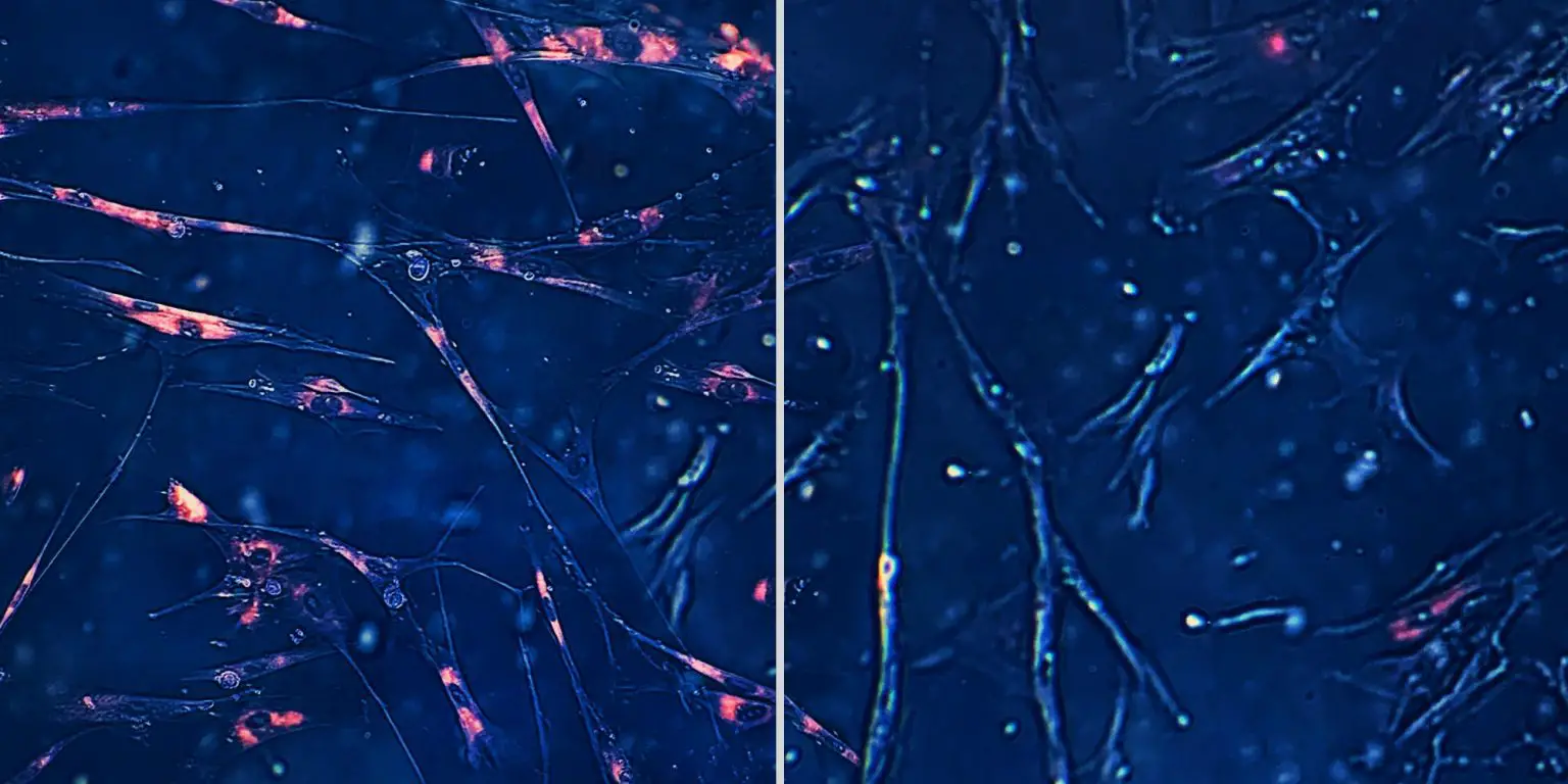 Targeting-Senescent-Cells-With-AI-1536x768.webp