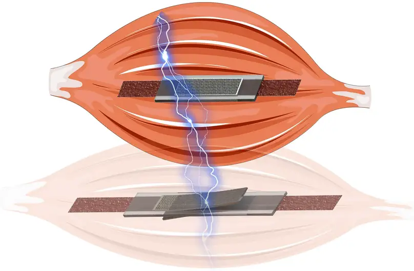 Electric-Self-Sensing-and-Variable-Stiffness-Artificial-Muscle.webp