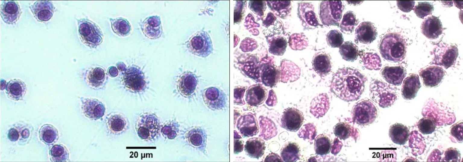 AML-vs-Human-Alveolar-Macrophages-1536x539.webp
