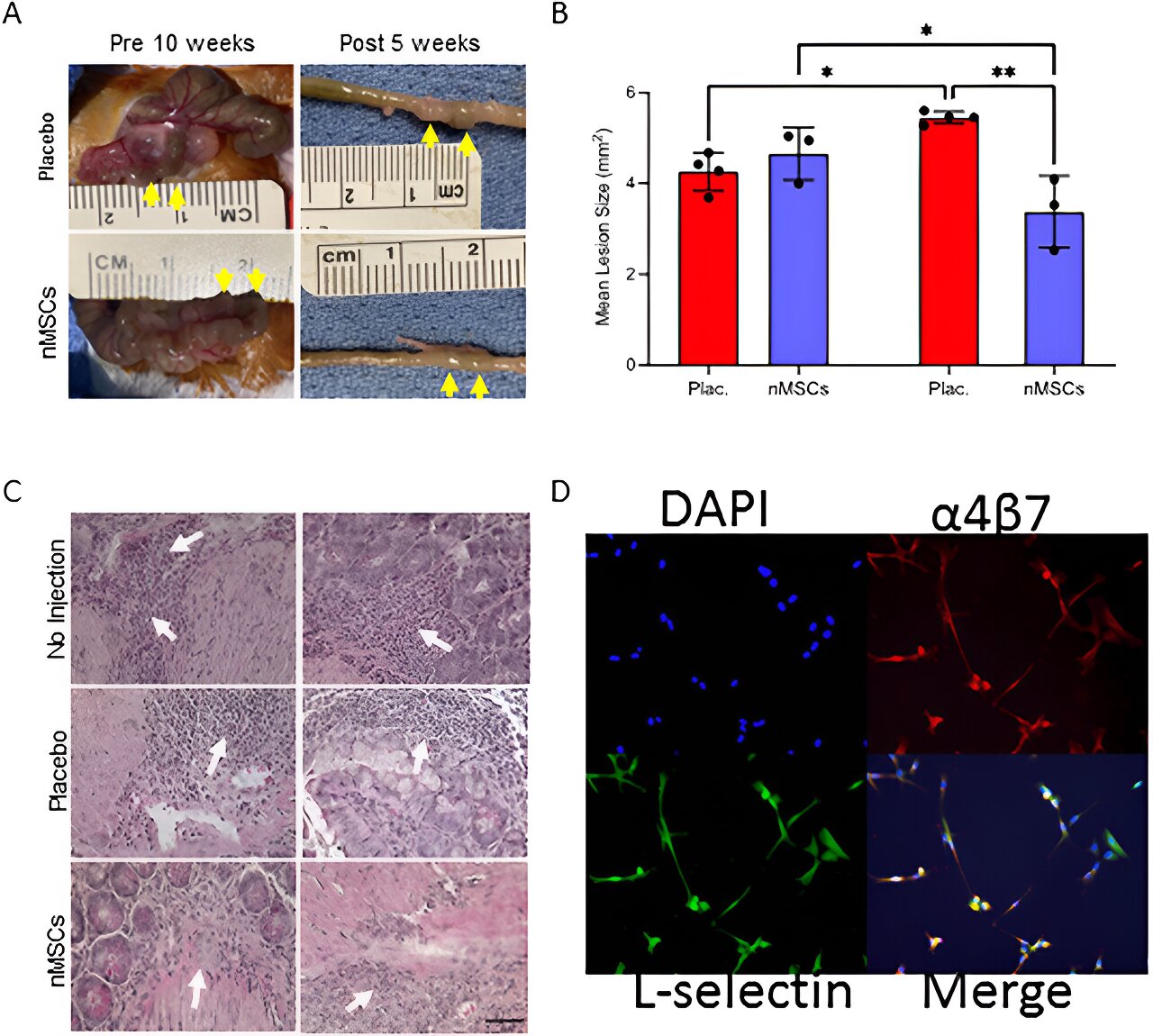 neonatal-stem-cells-fr.jpg
