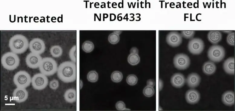 Blocking-Fatty-Acid-Synthesis-Kills-Dangerous-Fungi-777x368.webp
