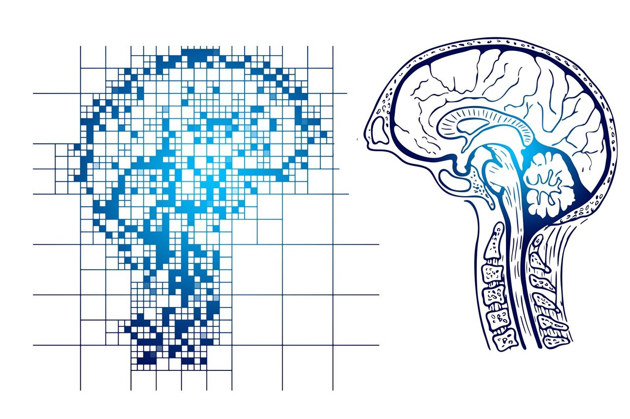 alzheimer.jpg