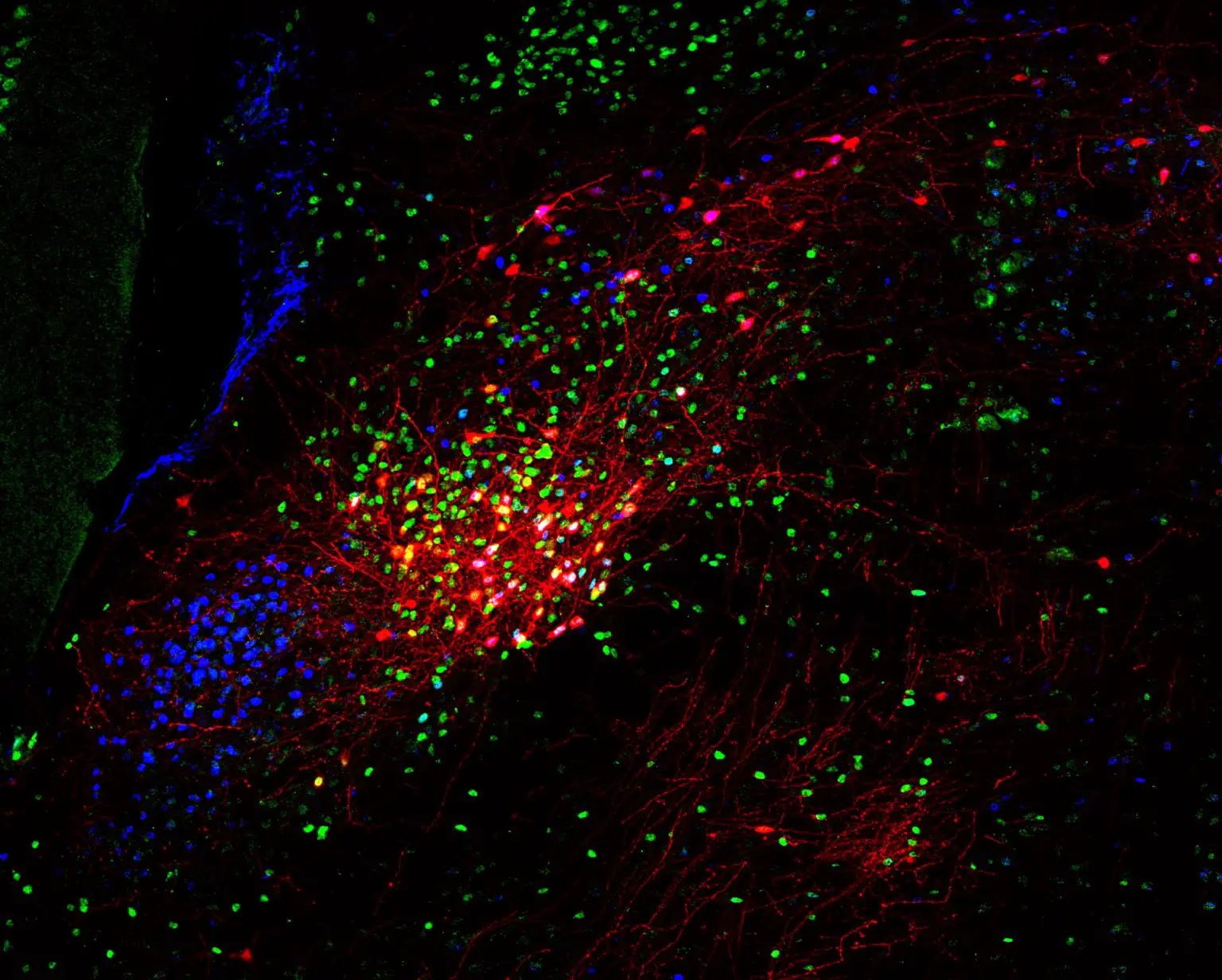 Neurons-in-Parabrachial-Nucleus-Brain-1536x1232.webp