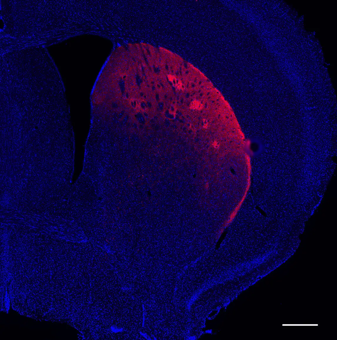 Dopamine-Neuron.webp