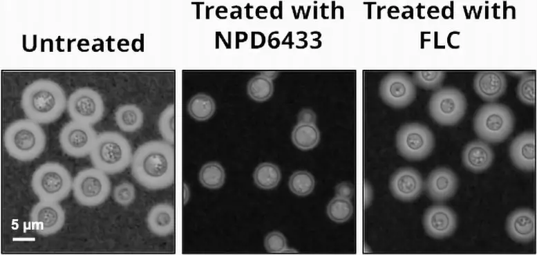 NPD6433-Fungus-Treatment.webp