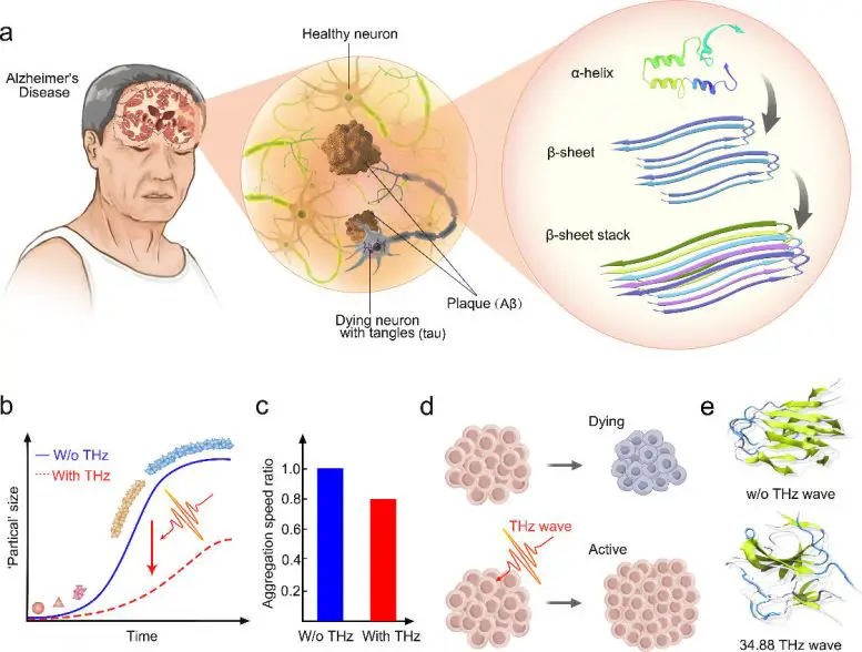 Schematic-of-Potential-Alzheimers-Treatment-Using-High-Frequency-Terahertz-Radiation-777x588.webp