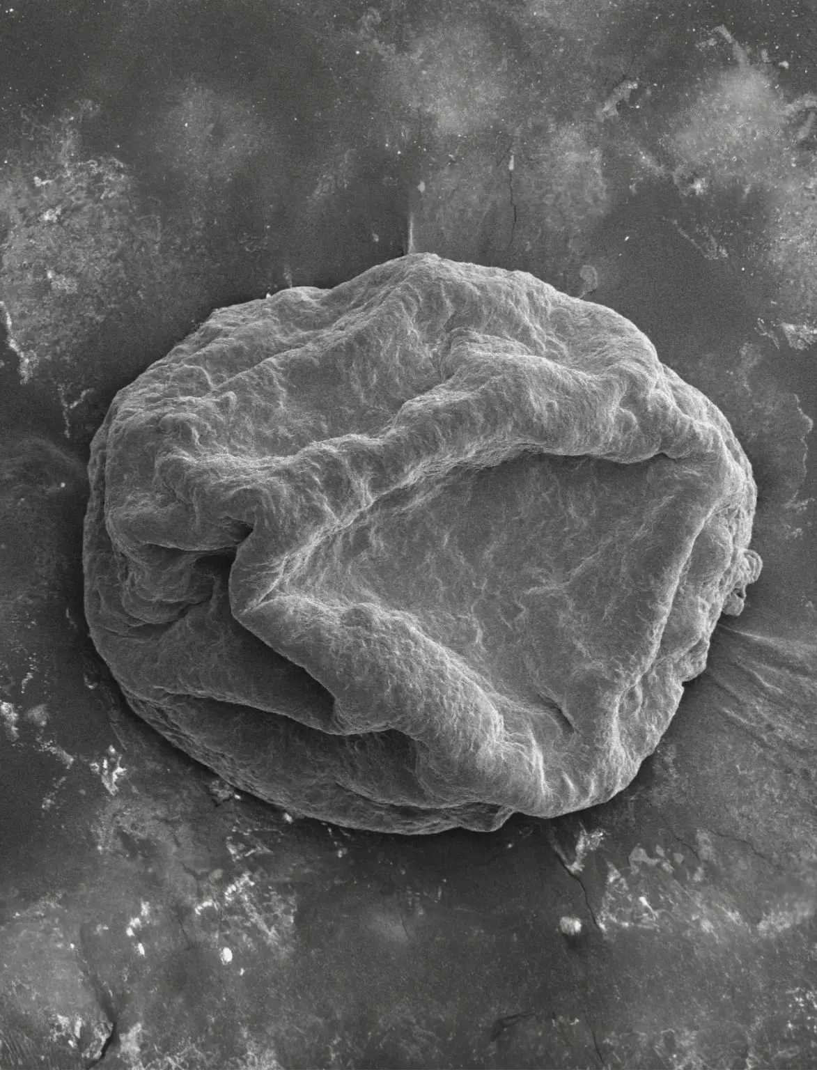 Electron-Microscopy-Heart-1173x1536.webp