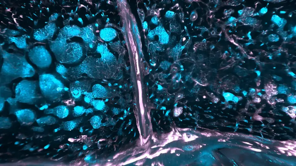 Mmune-Cells-in-Blue-and-Vessels-in-Pink-in-the-Bone-Marrow-of-the-Skull-2048x1146.webp