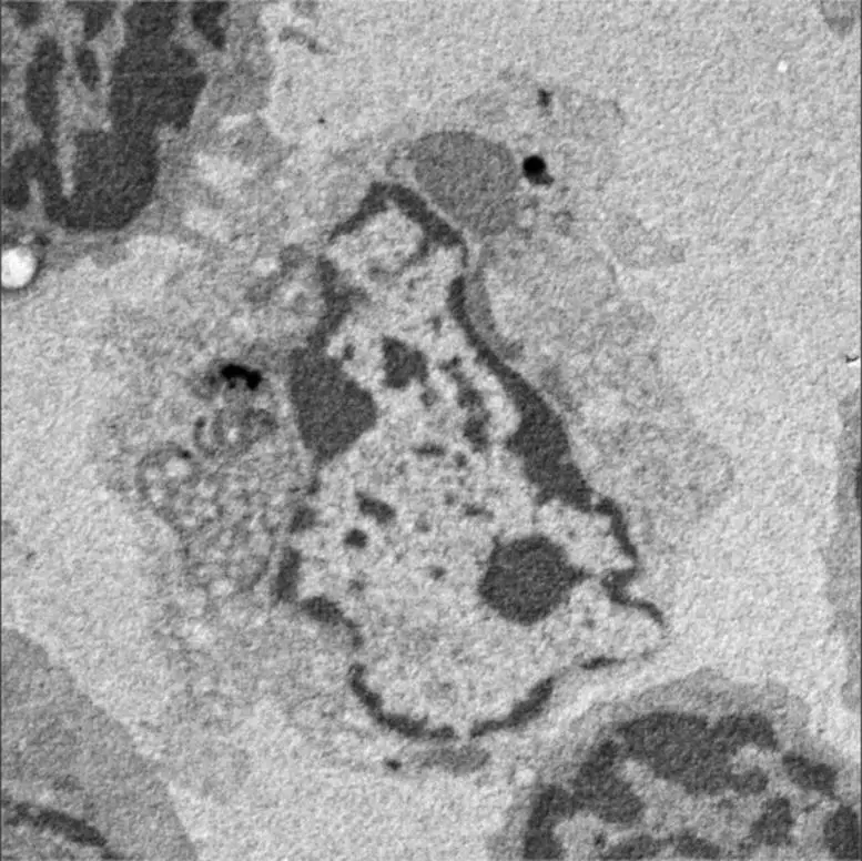 Dead-T-Cell.webp