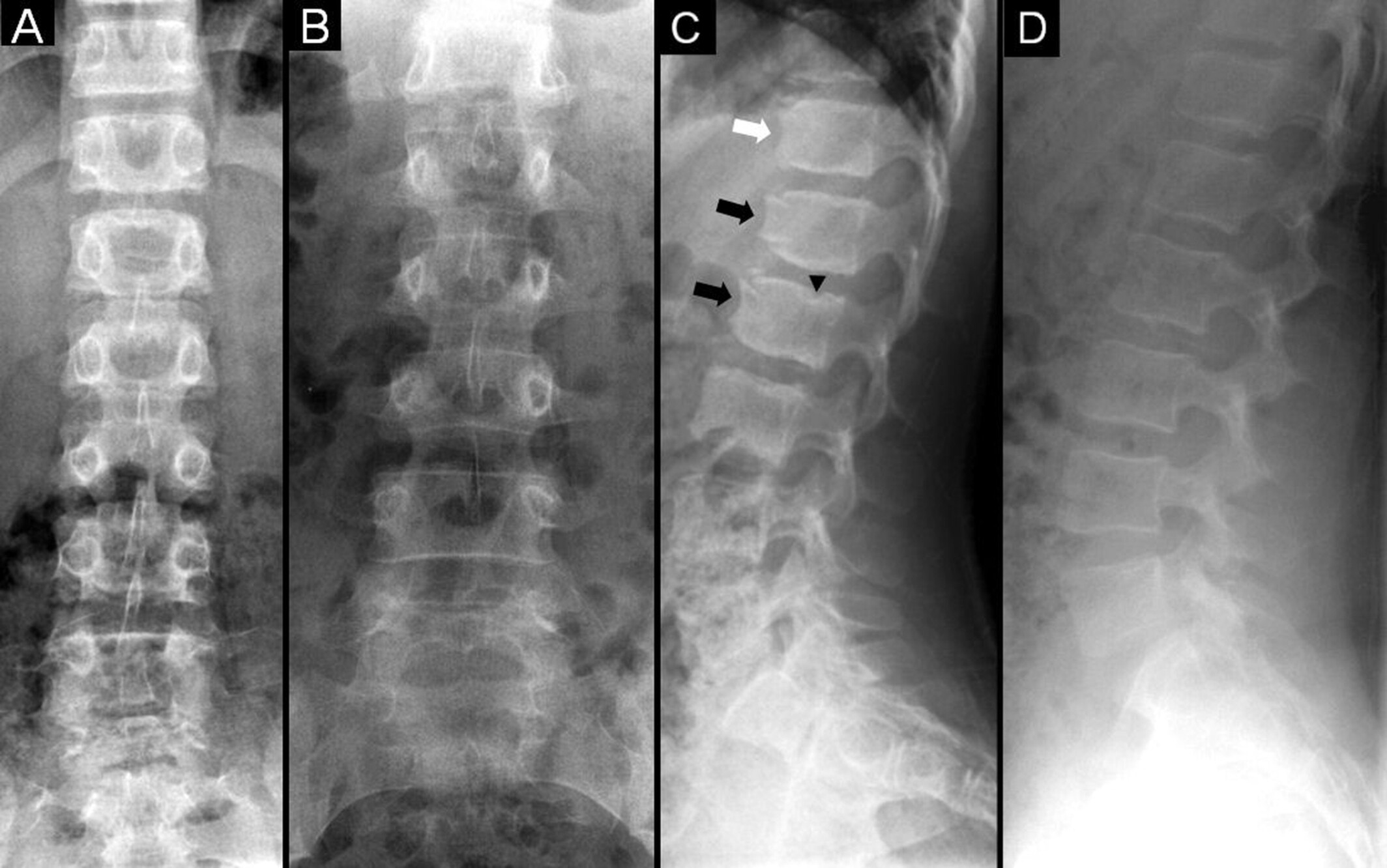 jbmr4827-fig-0001-m.jpg