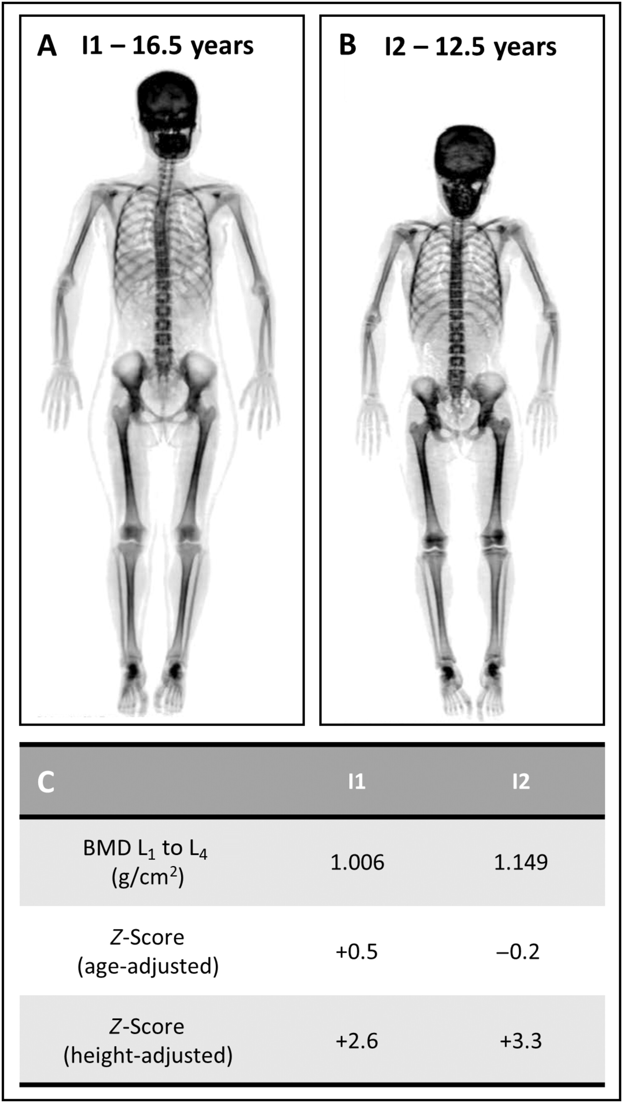 jbmr4827-fig-0002-m.jpg