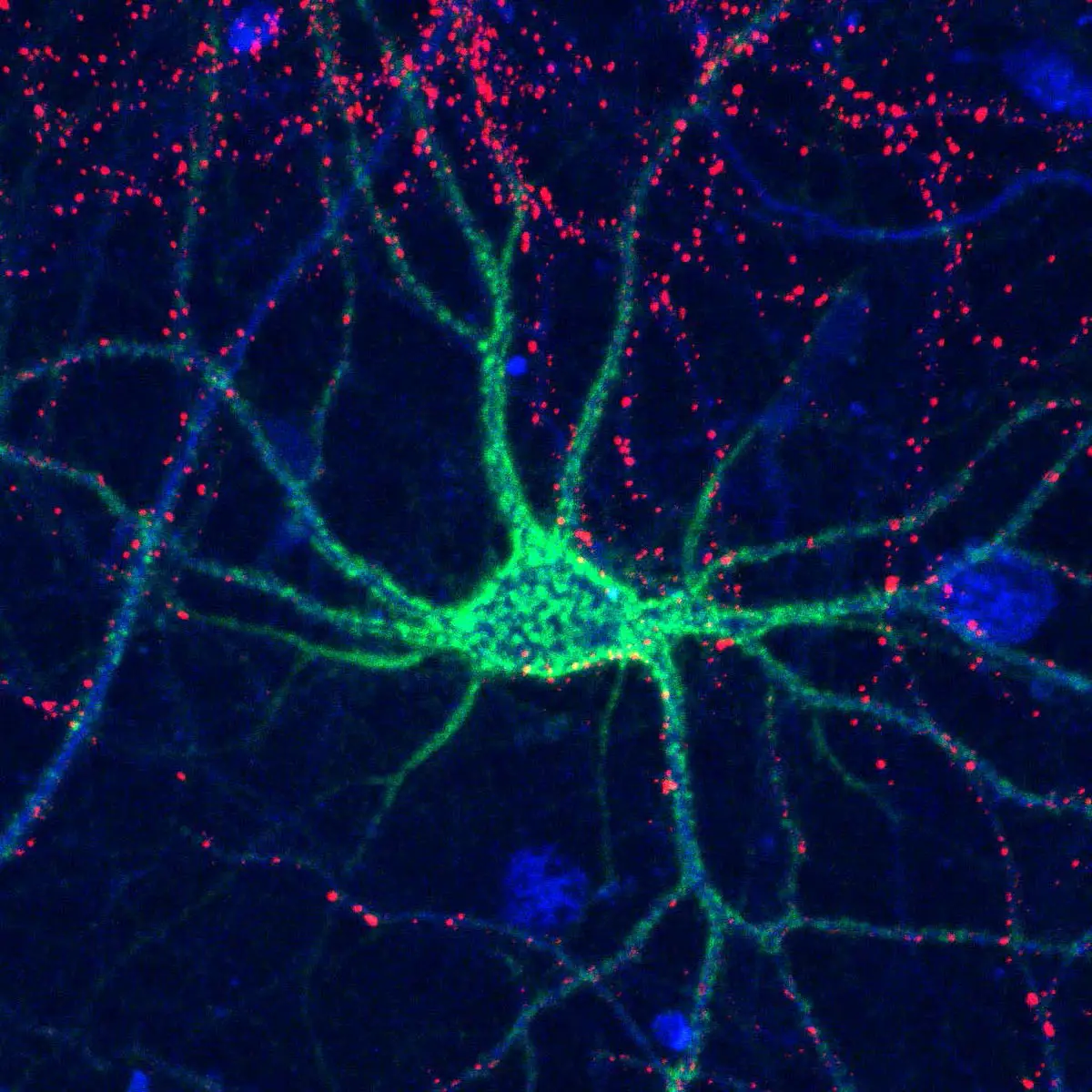 Sugars-Affect-Brain-Plasticity.webp