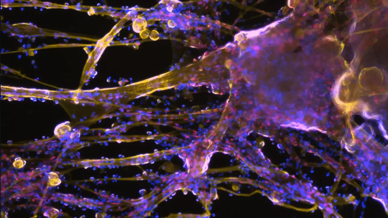 Muscle-Stem-Cells-and-Fibers-2048x1152.webp