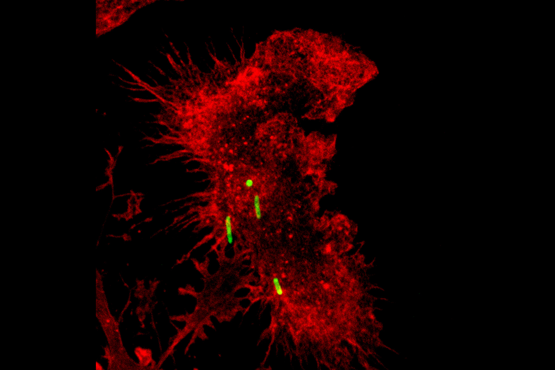 Mac-phalloidin-Ecoli-GFP-2_6x4.jpg