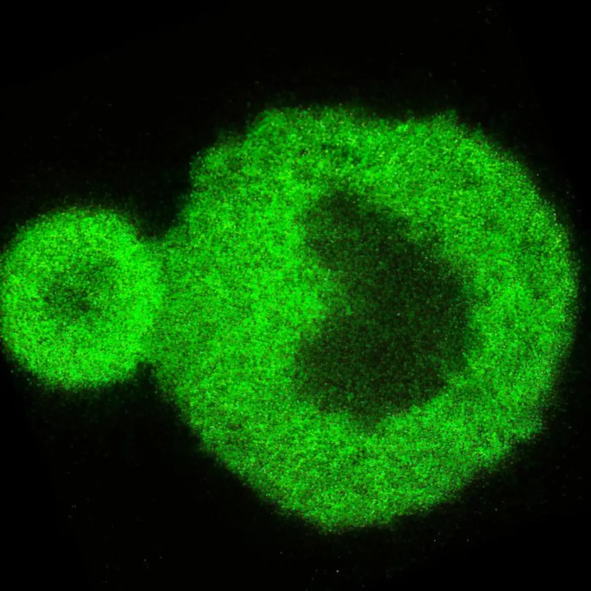 Nanoscale-Scan-Image-Showing-Protein-Condensate-Interaction.webp