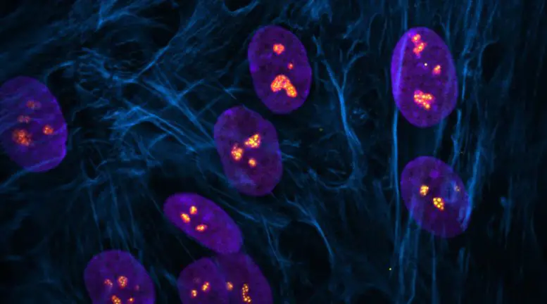 Fluorescent-Image-Showing-Cells-With-Normal-Nucleoli-in-Nuclei-777x432.webp