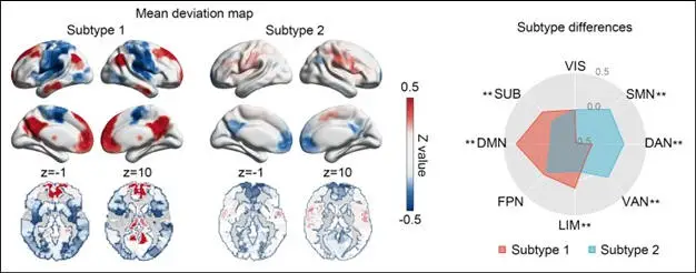 Brain-Imaging-Based-Biomarker-of-Depression-Identified.webp