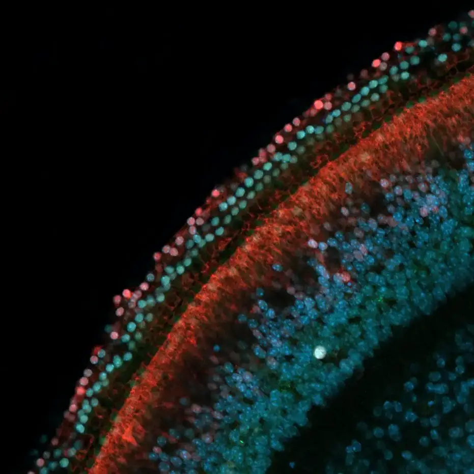 Rows-of-Sensory-Hearing-Cells-Next-to-Supporting-Cells.webp