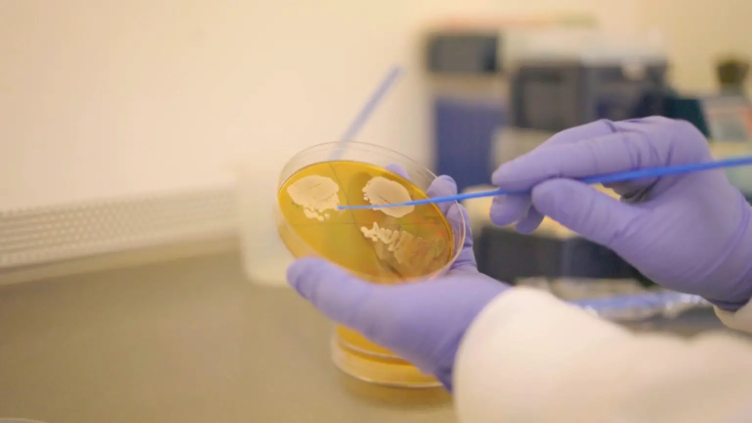 Picking-Yeast-From-a-Plate-1536x864.webp