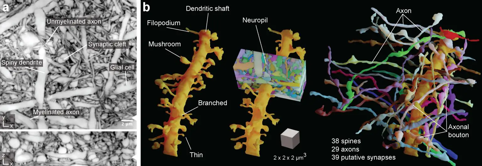 LIONESS-Delineates-the-Complexity-of-Dense-Brain-Tissue-1536x531.webp