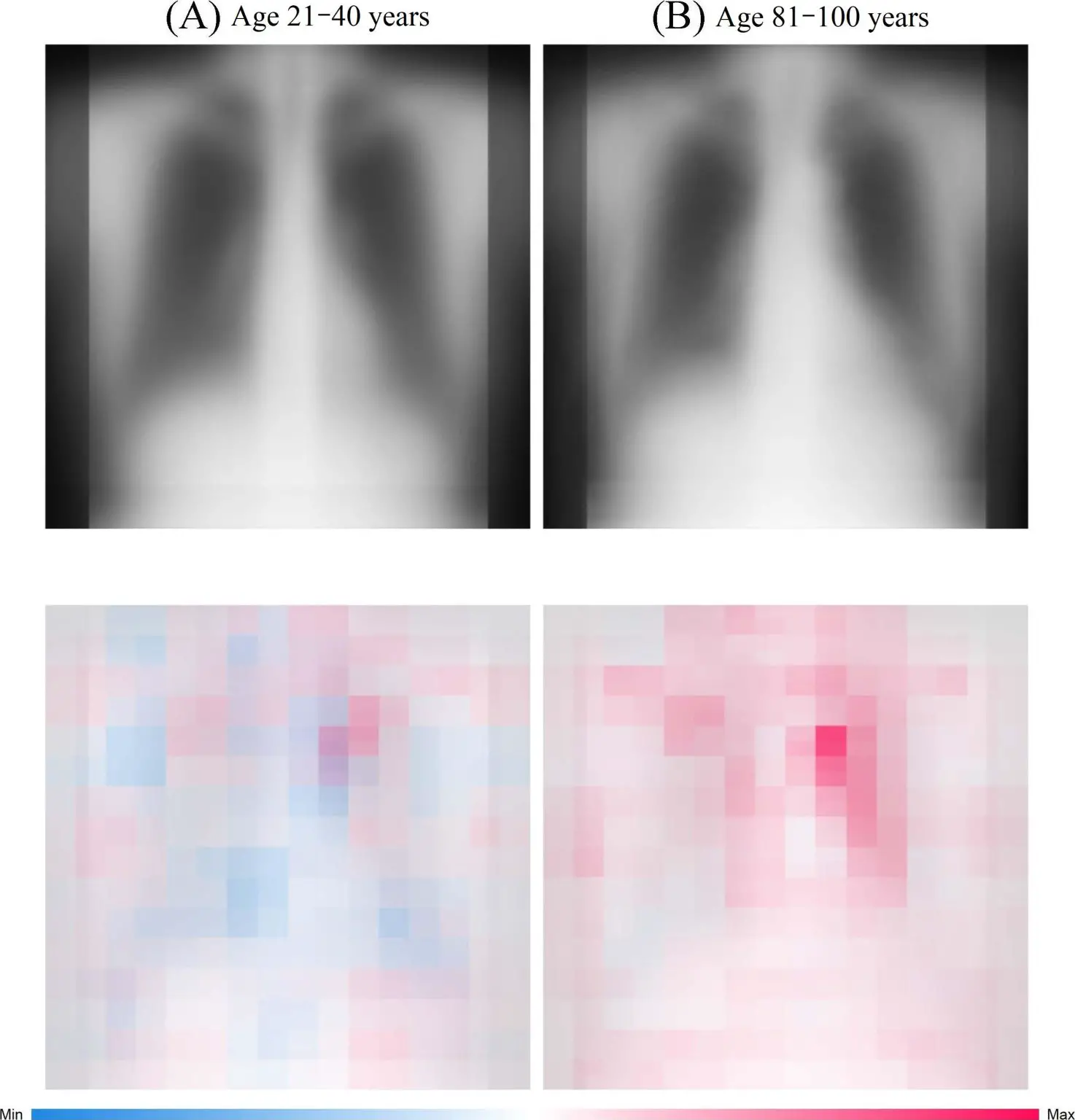Chest-Radiographs-AI-1474x1536.webp