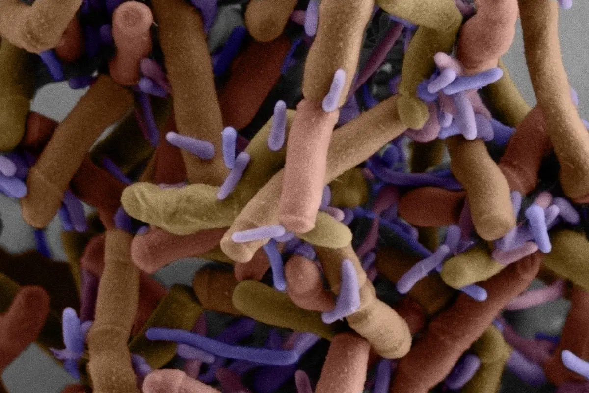 Epibiotic-Bacteria-Growing-on-Host-Cell.webp