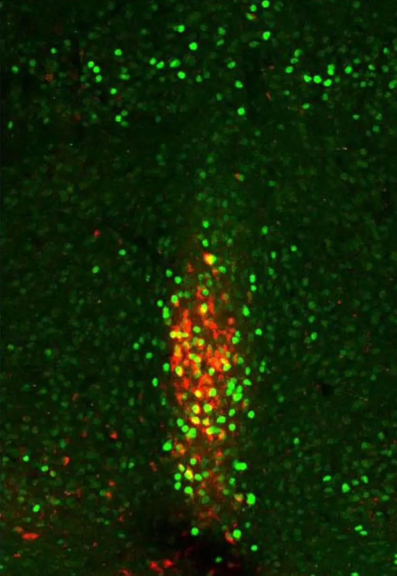 Xiphoid-Nucleus.webp