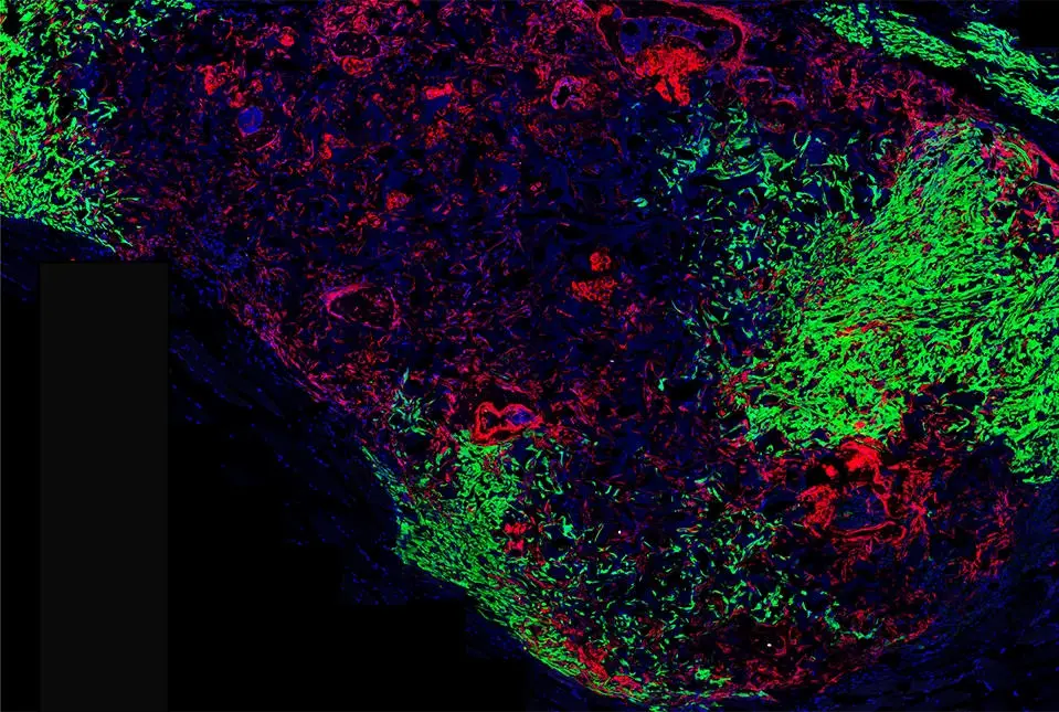New-Stem-Cell-That-Forms-the-Spine.webp