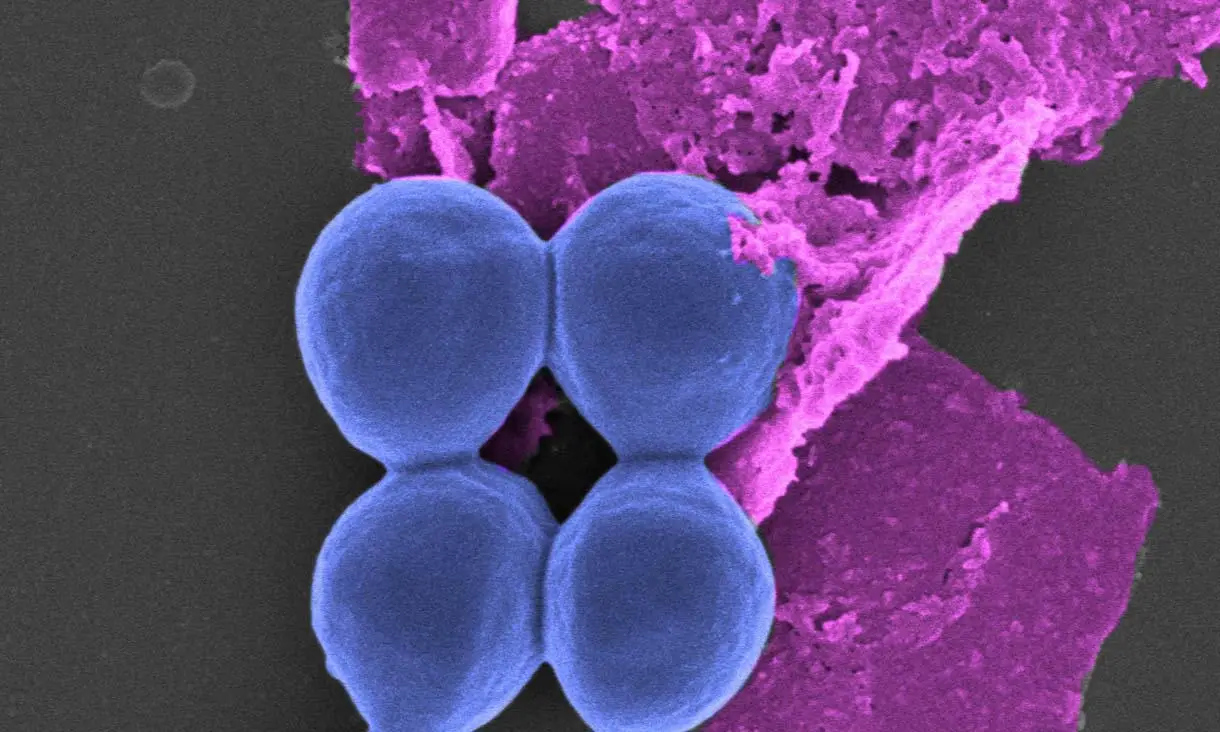 Black-Phosphorus-Treatment-on-Bacteria.webp