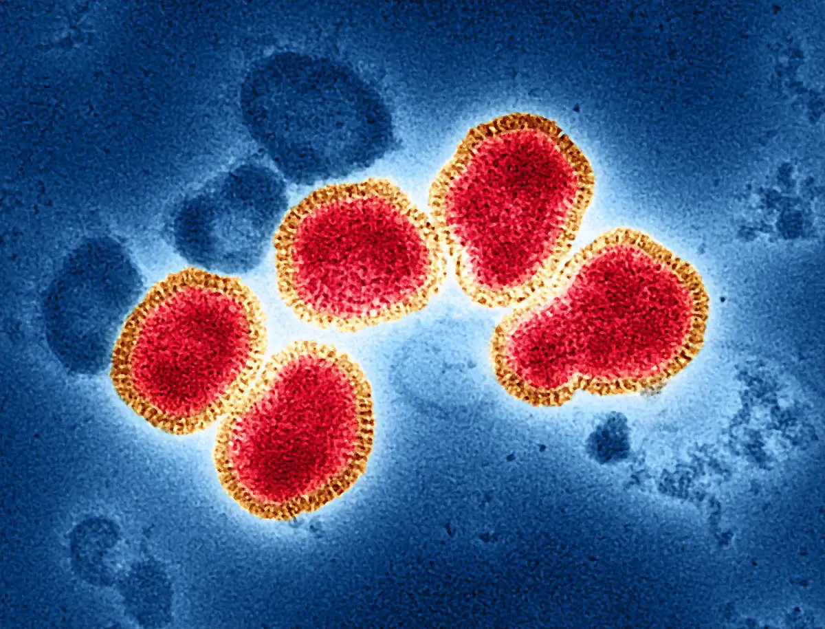 Influenza-A-Virus-H3N2.webp