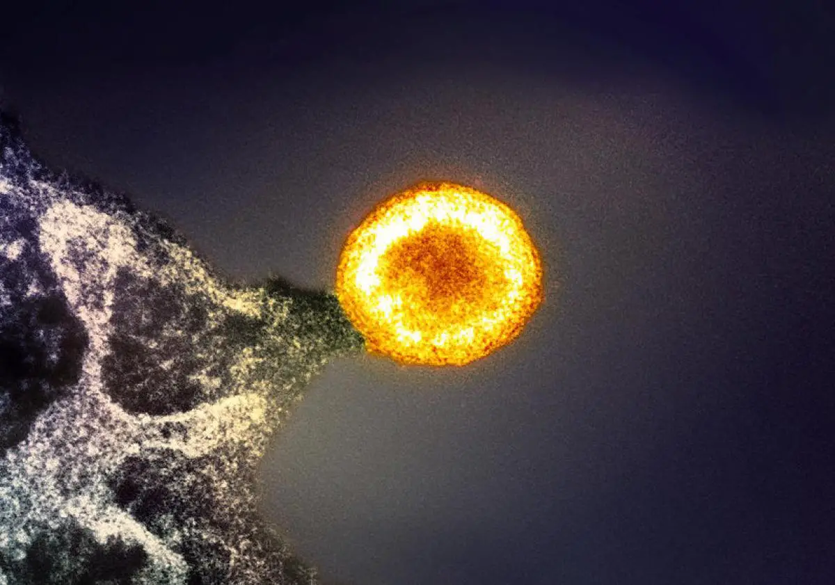HIV-1-Virus-Particle.webp