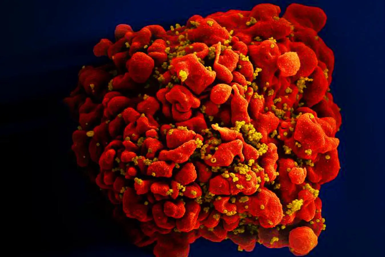 HIV-Immune-Cell.webp