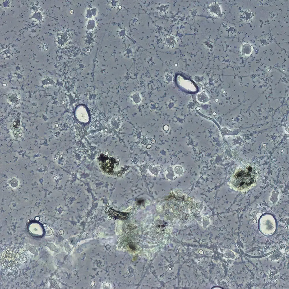 Amoebae-and-Red-Algae.webp