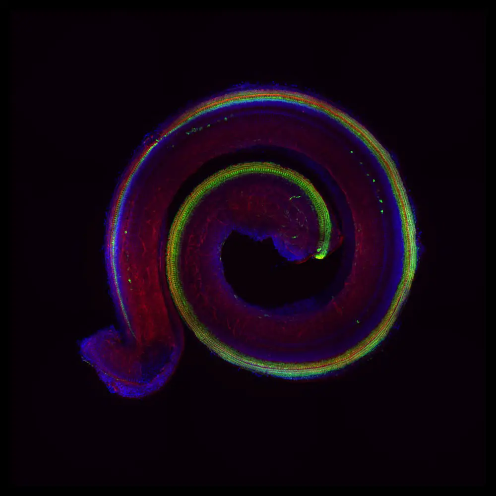 Fluorescence-Microscopic-Image-of-a-Murine-Cochlea.webp