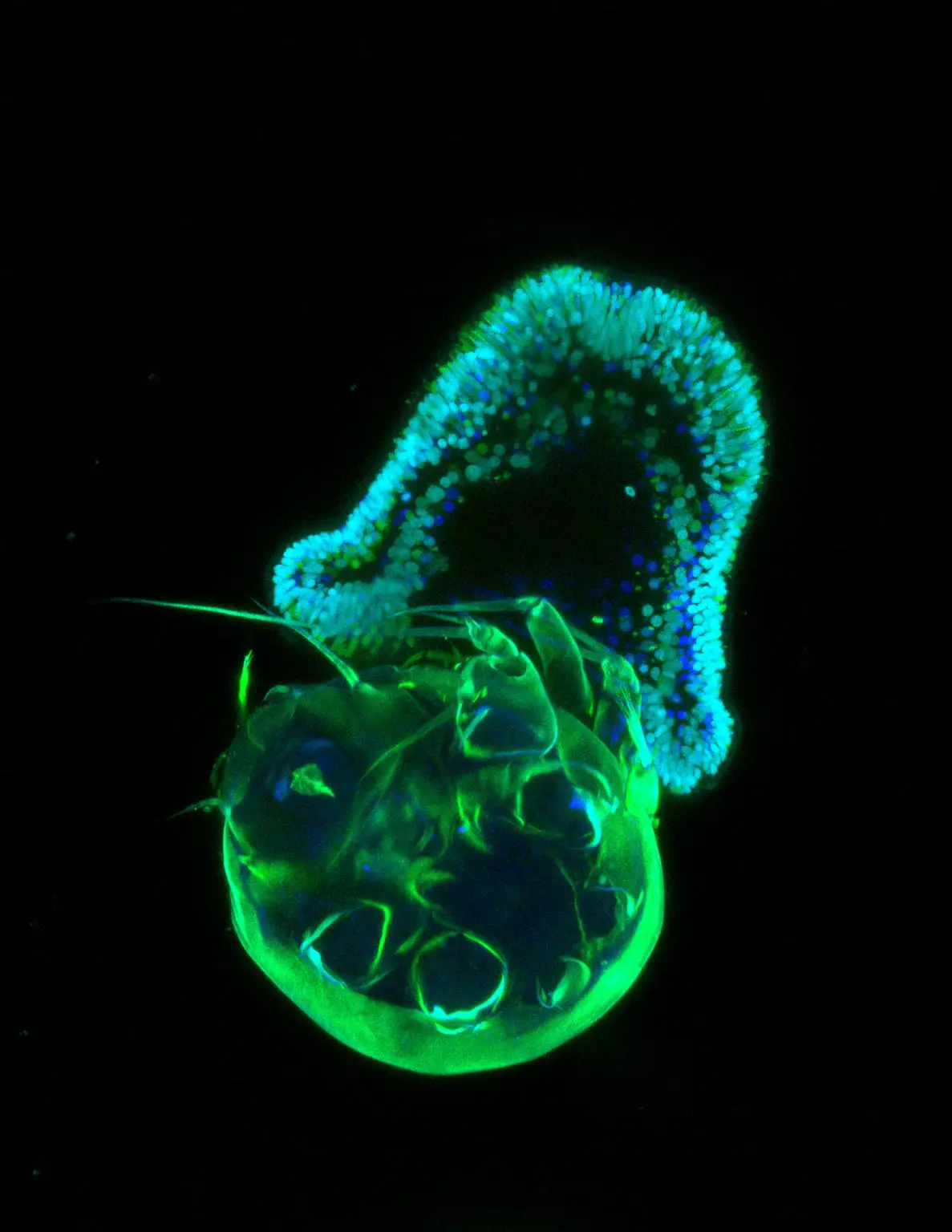 Early-Planula-Larval-Stage-of-the-Sea-Anemone-Aiptasia-1187x1536.webp