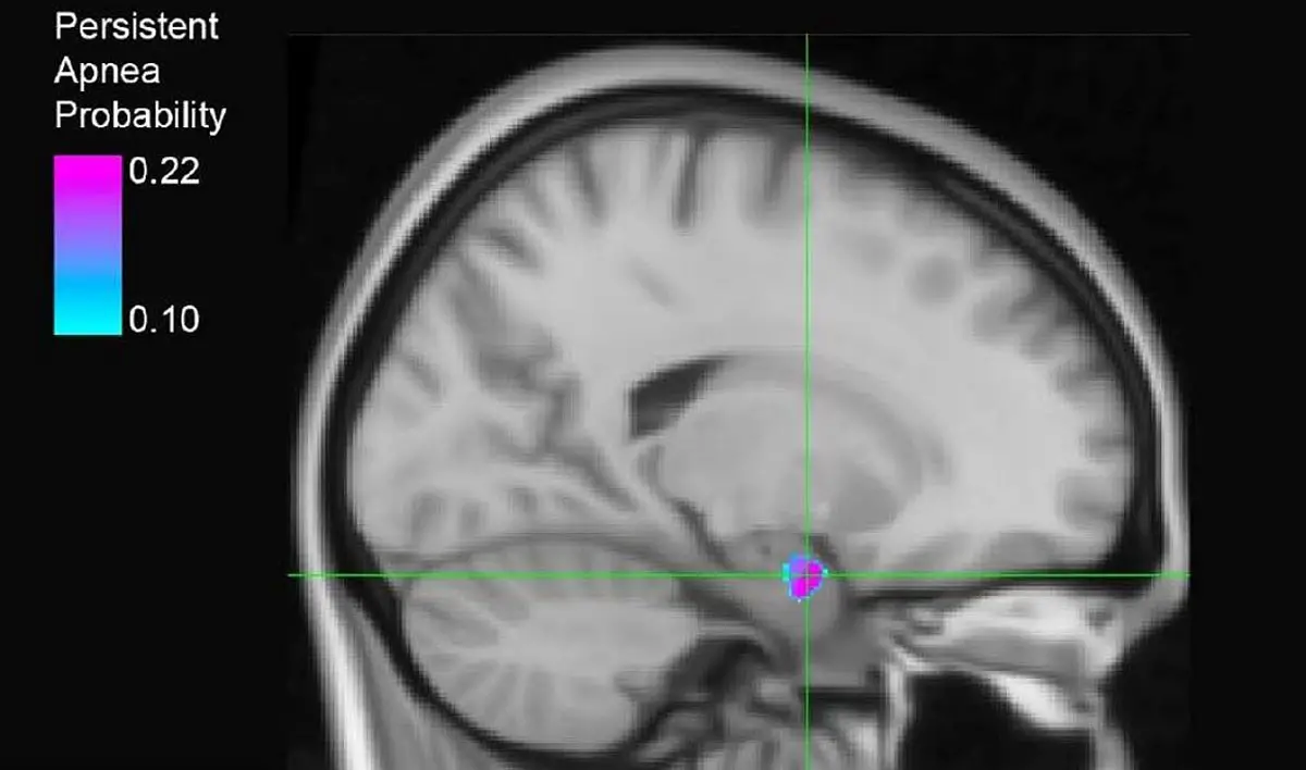 Brain-Region-Associated-With-Breathing-Failure-Following-Seizures.webp
