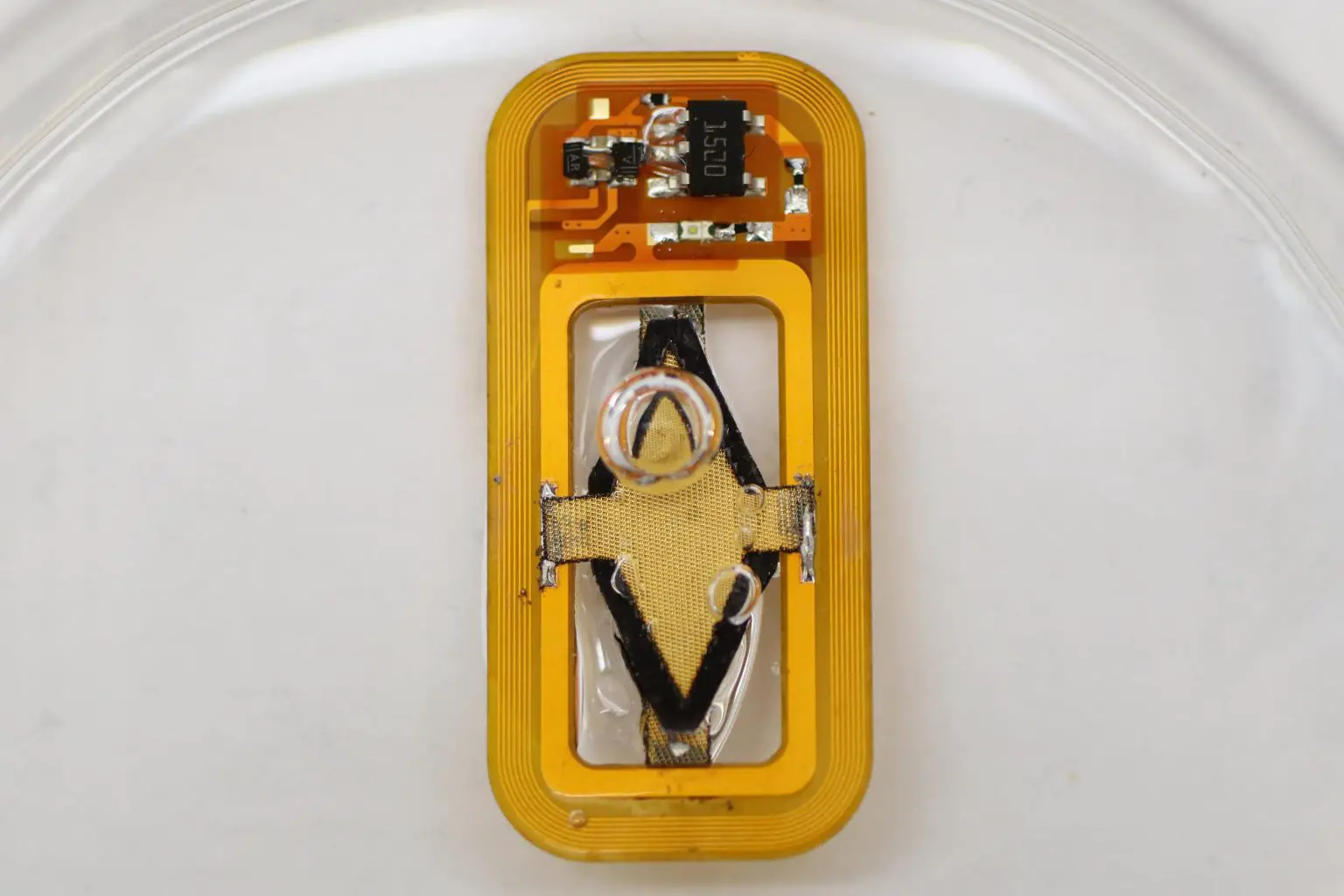 Implantable-Diabetes-Control-Device-1536x1024.webp
