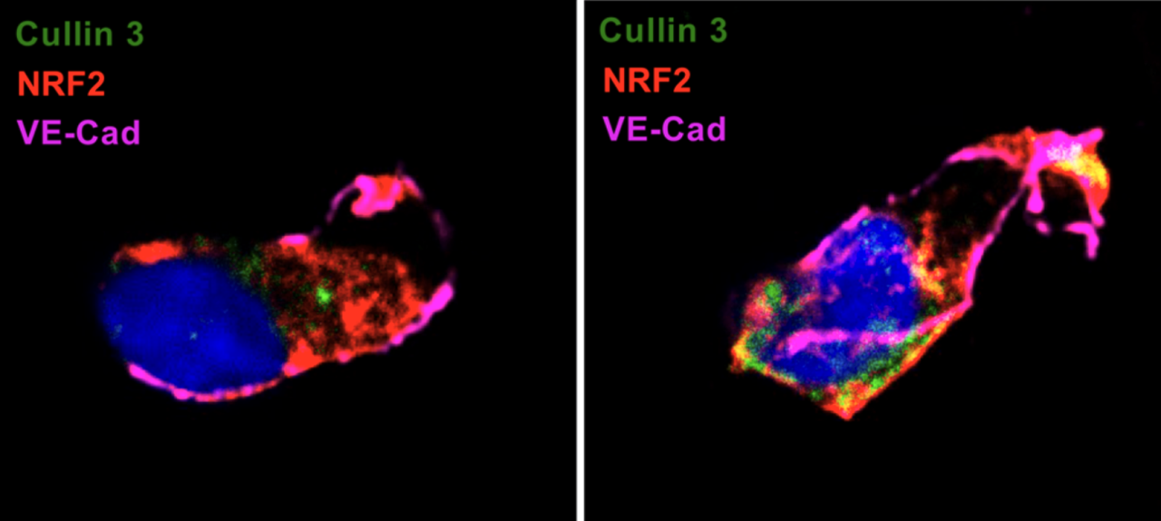 jelic_fig2a_effect_of_poor_sleep_on_vascular_cells.png