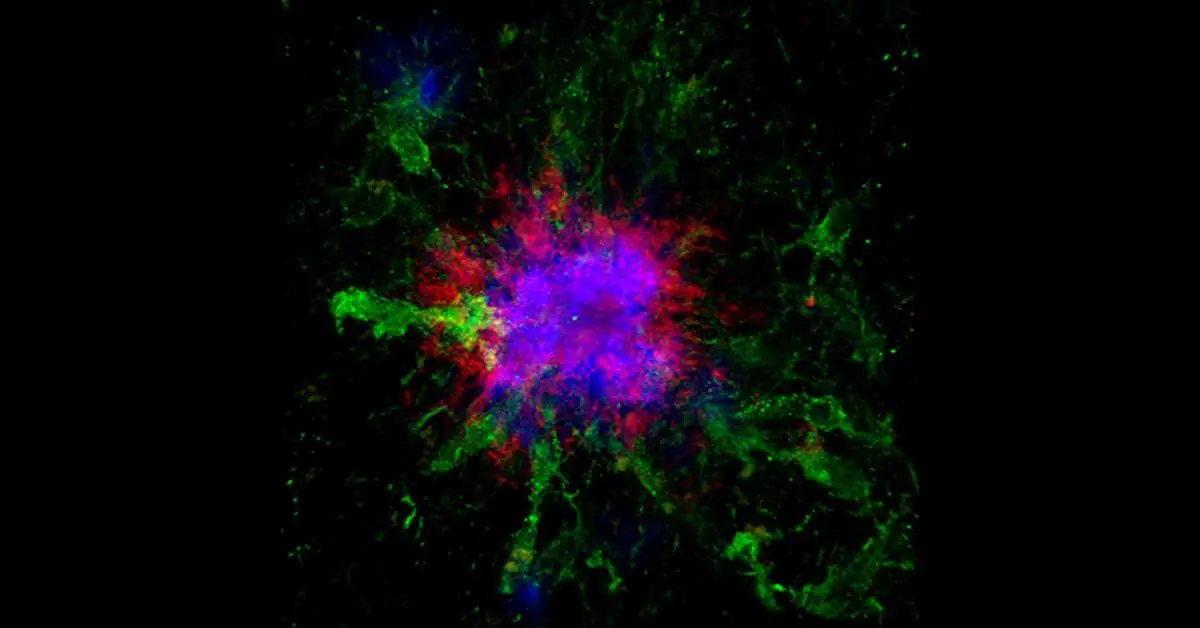 Desplats-Cell-Metabolism.webp