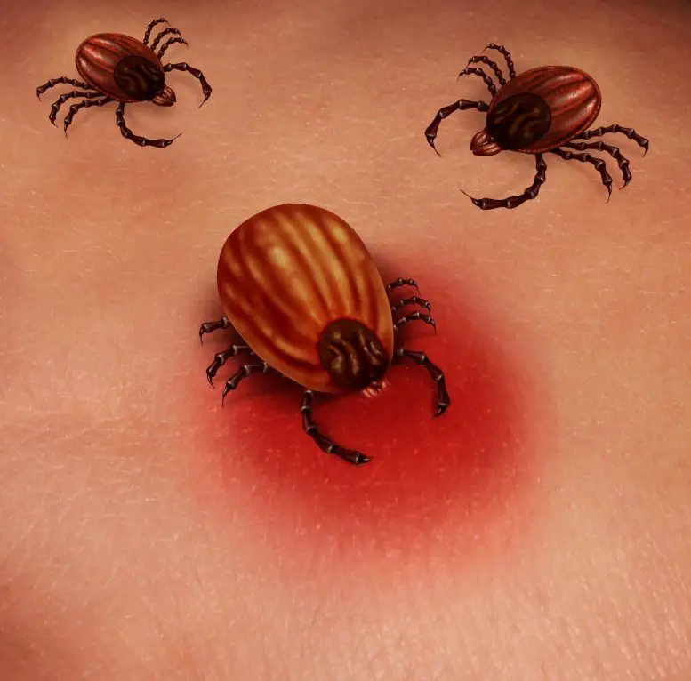 Lyme-Disease-Tick-777x766.webp