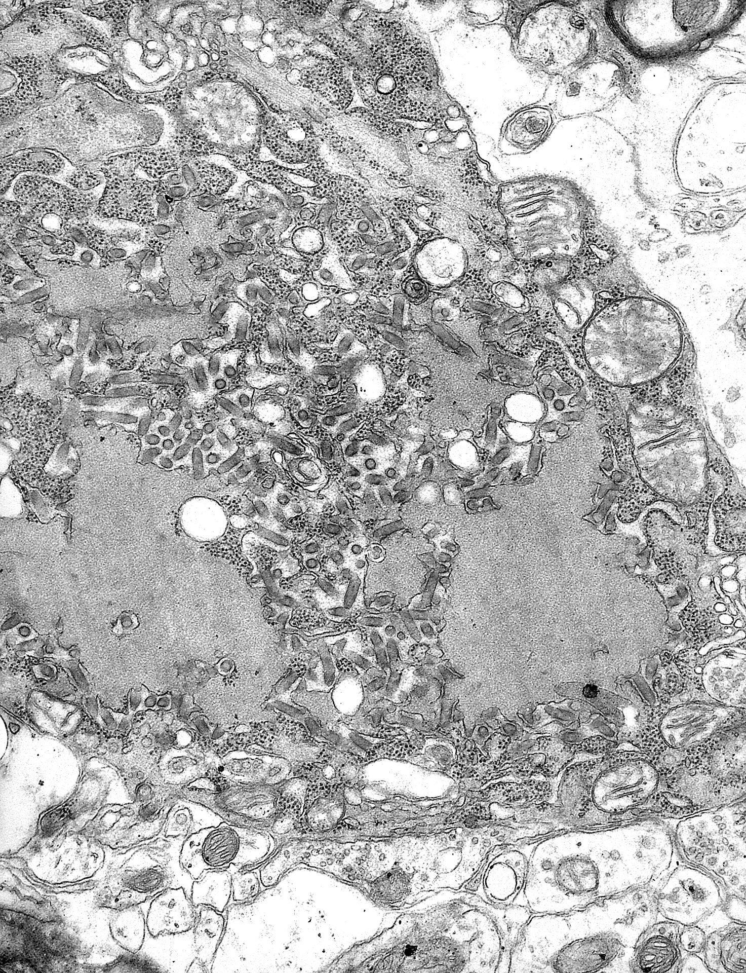 Rabies_Virus_EM_PHIL_1876.JPG
