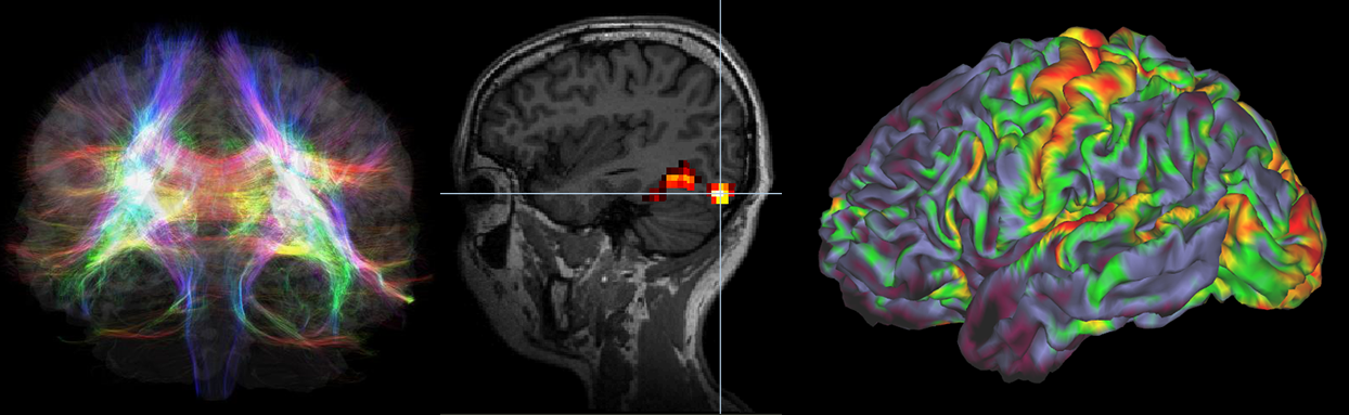 20201120brainimage.png