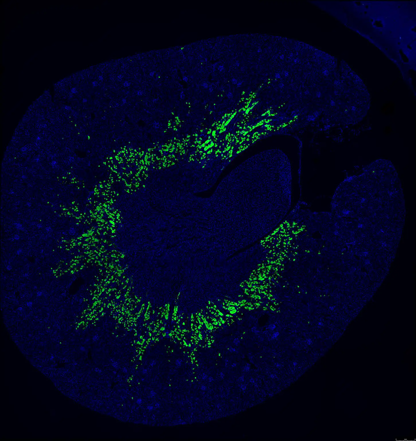 Cross-Sectional-View-of-the-Preclinical-Models-Kidney-Revealing-That-the-Omega-3-Lysolipid-Transporter-Mfsd2a-1451x1536.webp