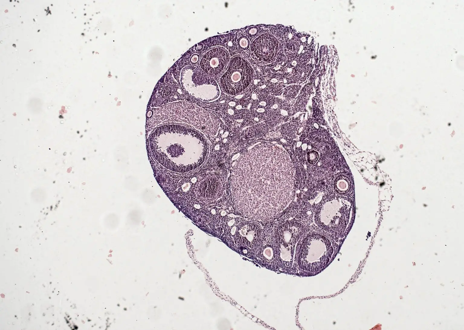 Ovarian-Tissue-Section-1536x1092.webp